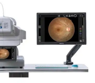 明达医学免散瞳眼底照相机RetinaStation使用步奏