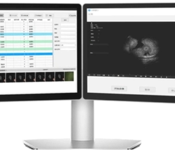 TOPCON眼科医学影像存储传输软件Hamony RS特点与维修方案