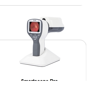 欧视博手持式免散瞳眼底照相机Smartscope Pro特点与使用步骤