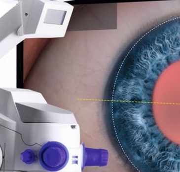 卡尔蔡司眼科导航手术显微镜ARTEVO 800特点和使用注意事项