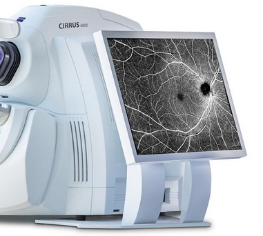卡尔蔡司眼科光相干断层扫描仪6000特点和使用注意事项