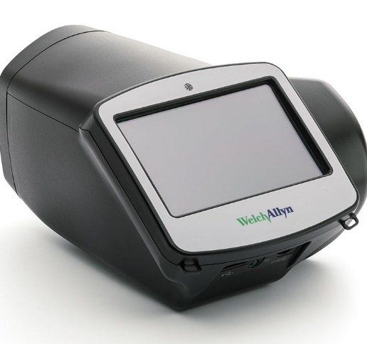 视力筛查仪对学龄前儿童视力异常早期识别的效果评估